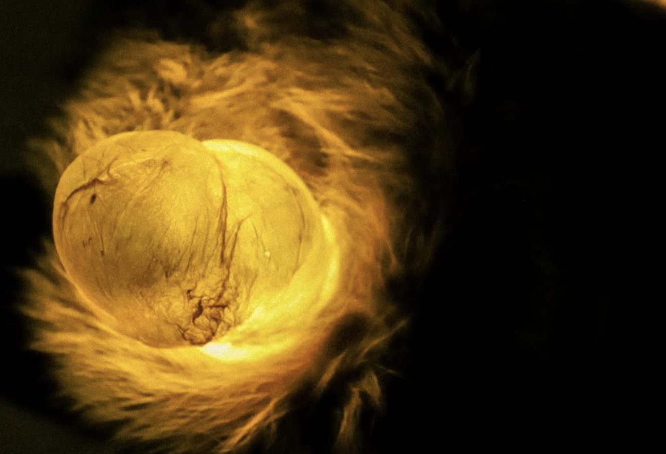 Close view of a glowing amber orb wrapped in fine, hair-like fibres.